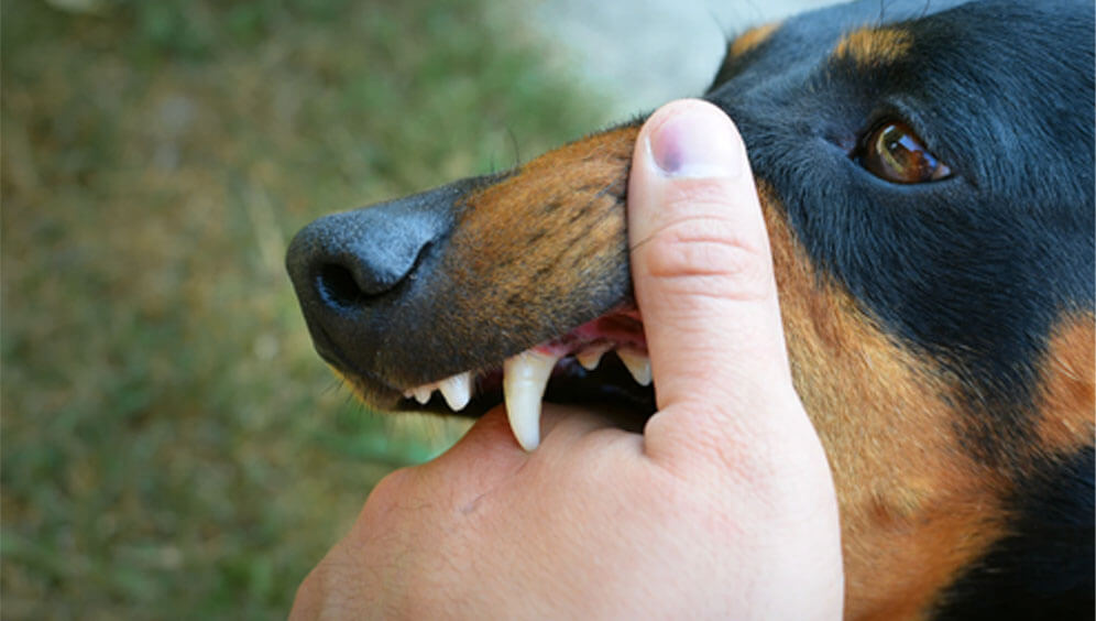 Vicious Dog Bites | Animal Attack | Pasadena, CA